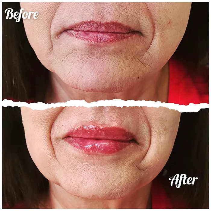 Vybe Aesthetics Picture 5