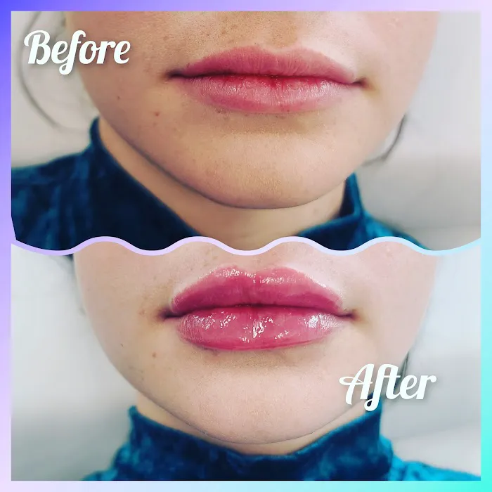 Vybe Aesthetics Picture 6