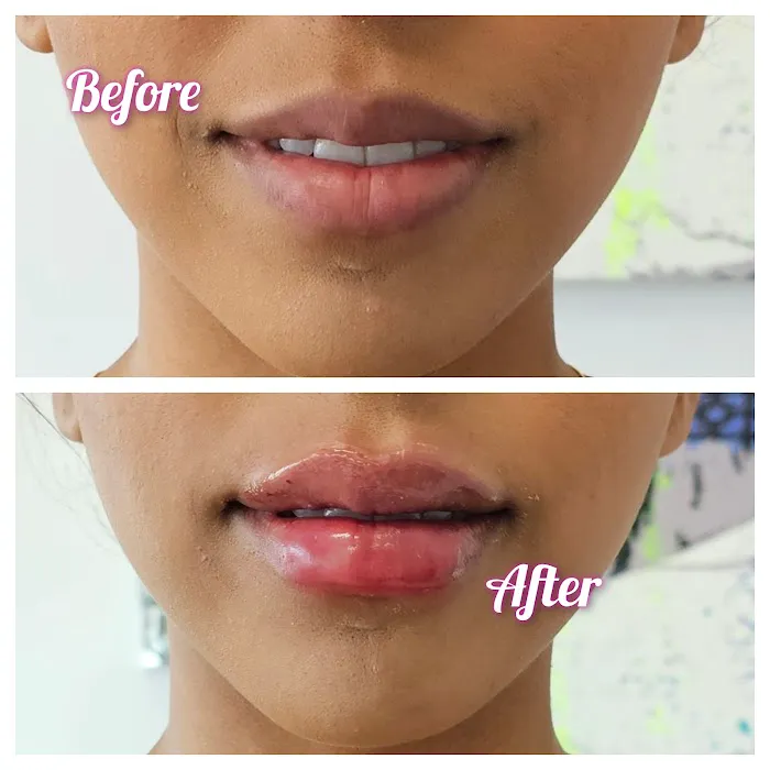 Vybe Aesthetics Picture 7