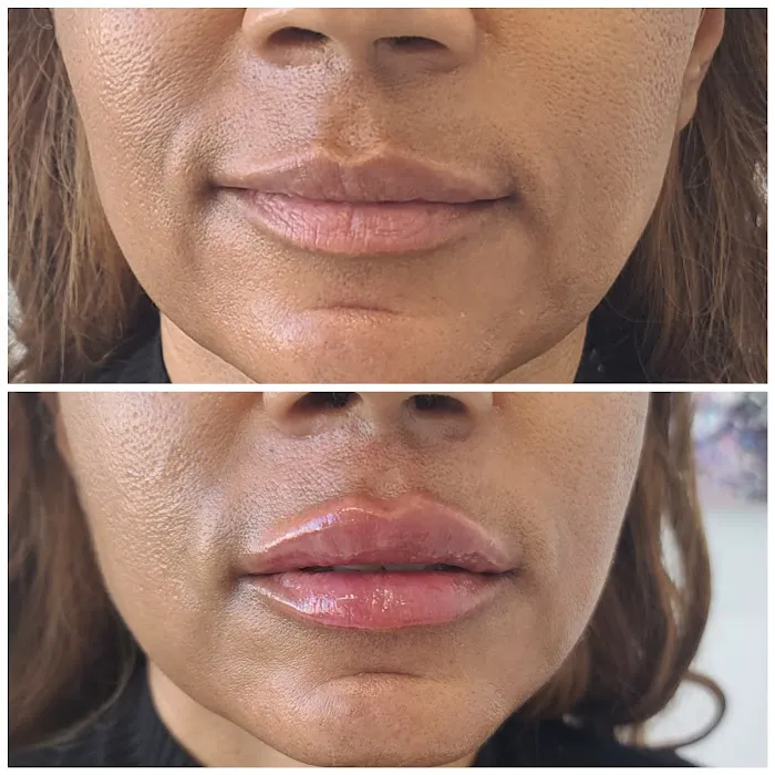 Vybe Aesthetics Picture 9