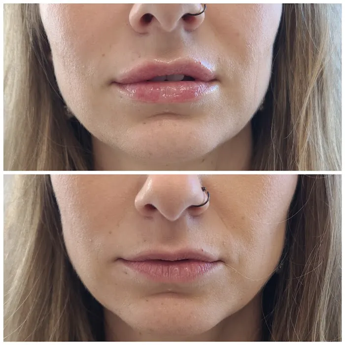 Vybe Aesthetics Picture 8