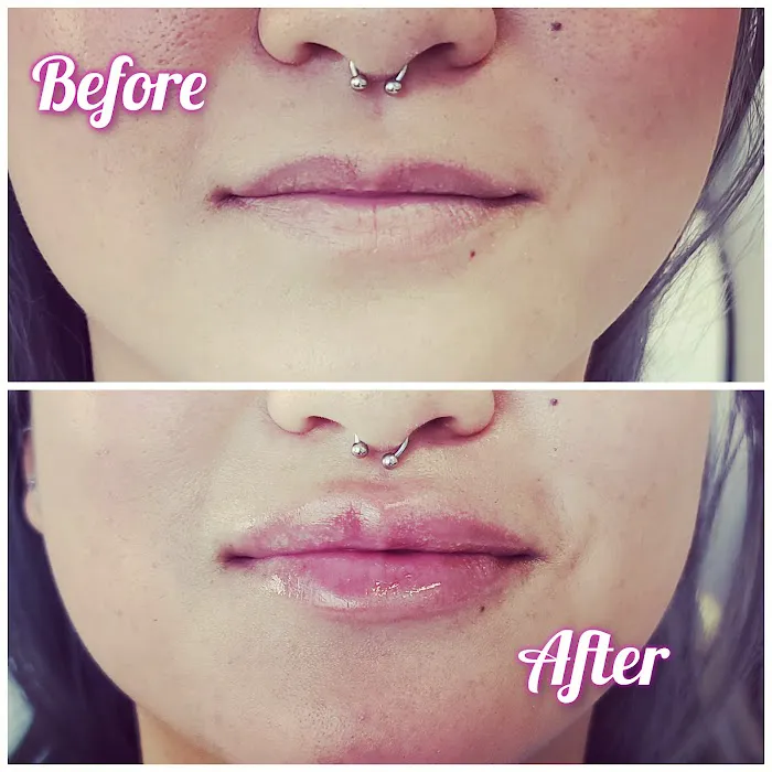 Vybe Aesthetics Picture 10