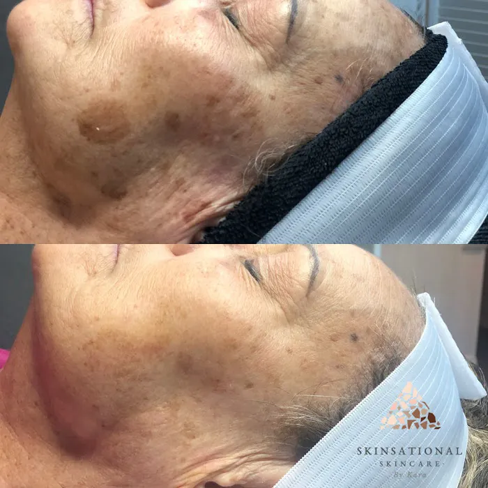 Skinsational By Kara Picture 4