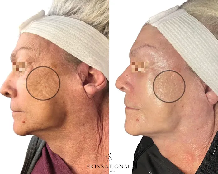 Skinsational By Kara Picture 6