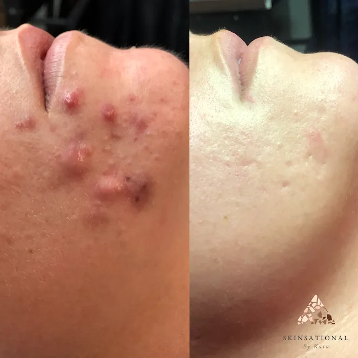 Skinsational By Kara Picture 10