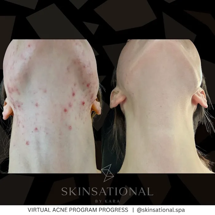 Skinsational By Kara Picture 9