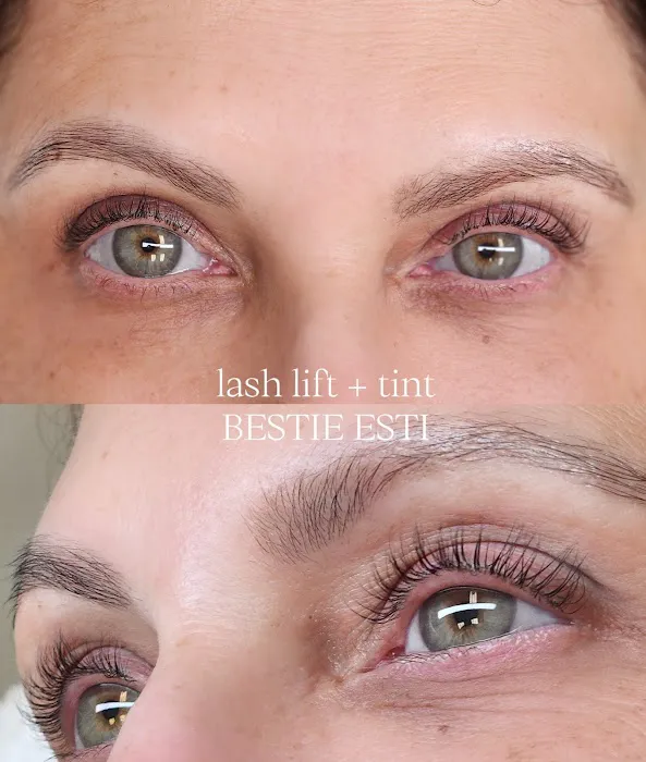 Bestie Esti Picture 3