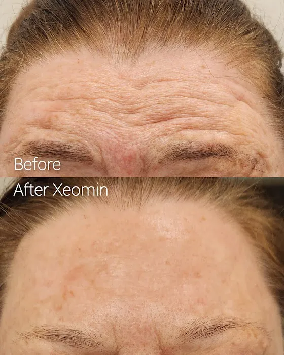 Bestie Esti Picture 1