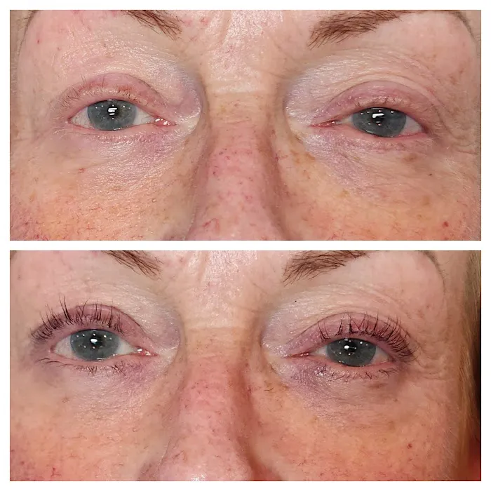 Bestie Esti Picture 4