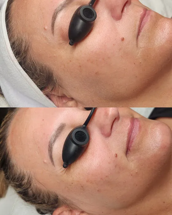 Bestie Esti Picture 9