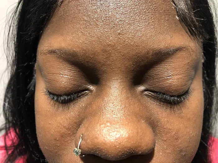 The Noire Skin Esthetics Picture 6