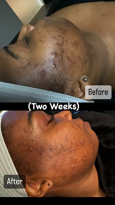 The Noire Skin Esthetics Picture 9