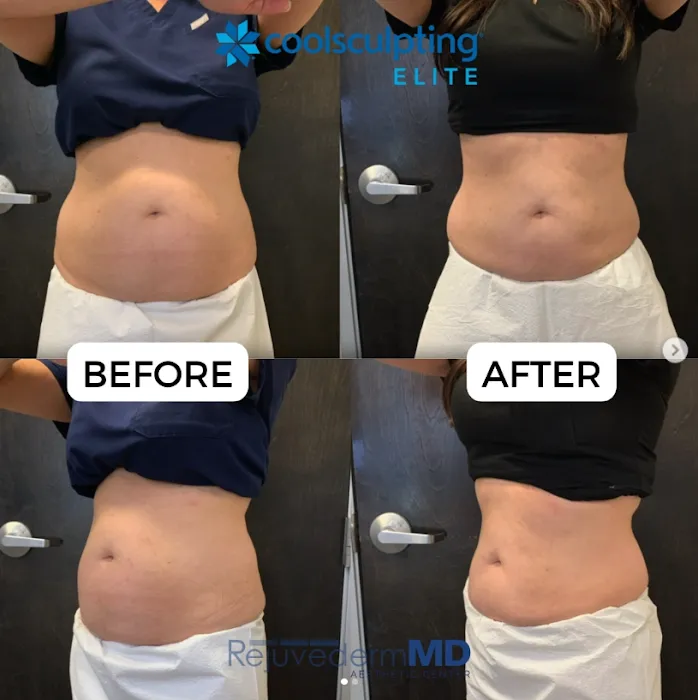 RejuvedermMD Aesthetic Center Picture 10