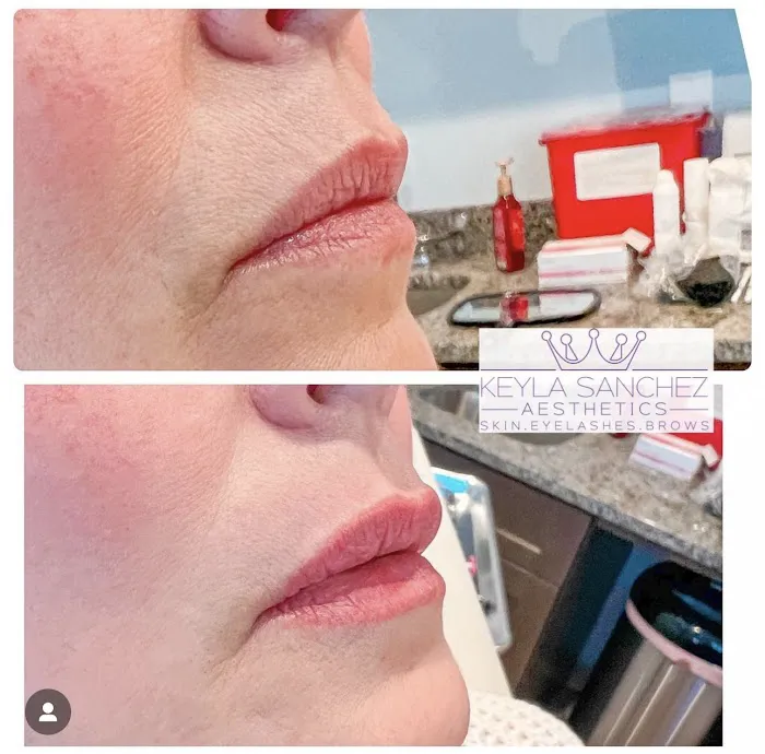 Keyla Sanchez Aesthetics Picture 1