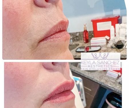 Keyla Sanchez Aesthetics