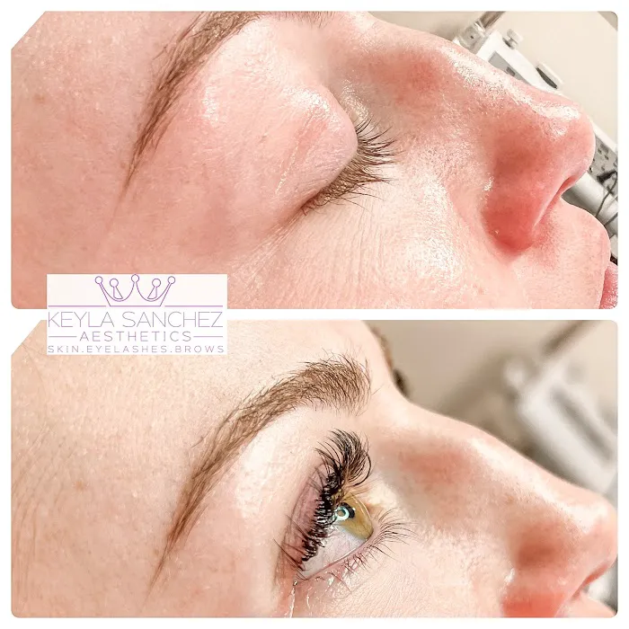 Keyla Sanchez Aesthetics Picture 3