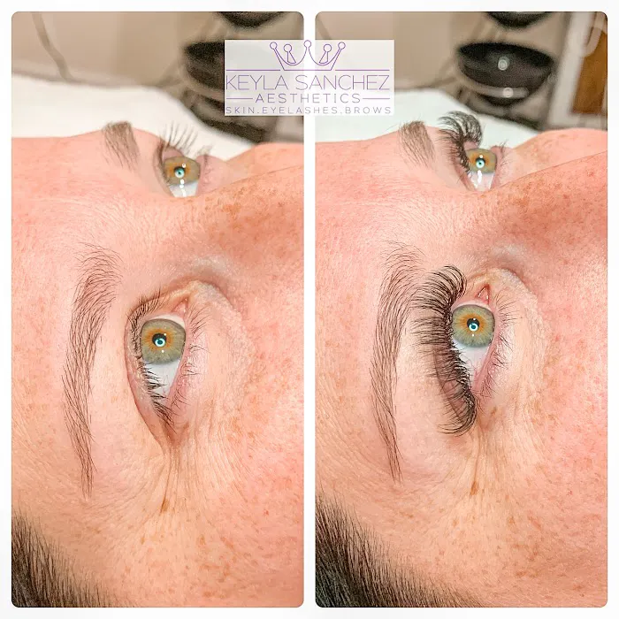 Keyla Sanchez Aesthetics Picture 4