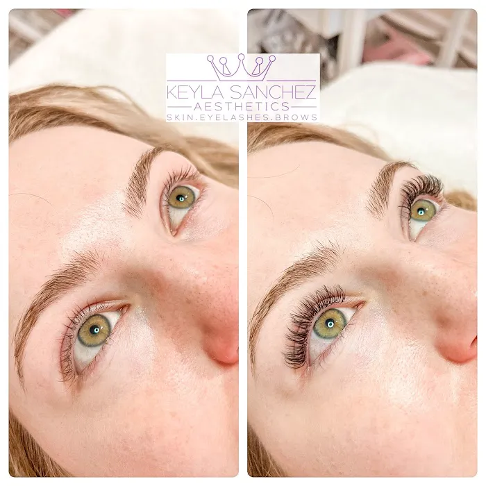 Keyla Sanchez Aesthetics Picture 8