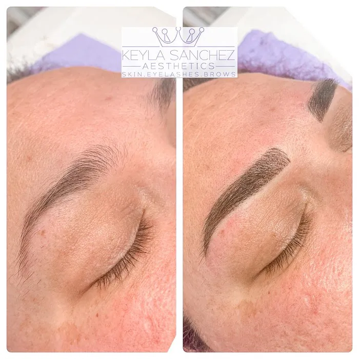 Keyla Sanchez Aesthetics Picture 6