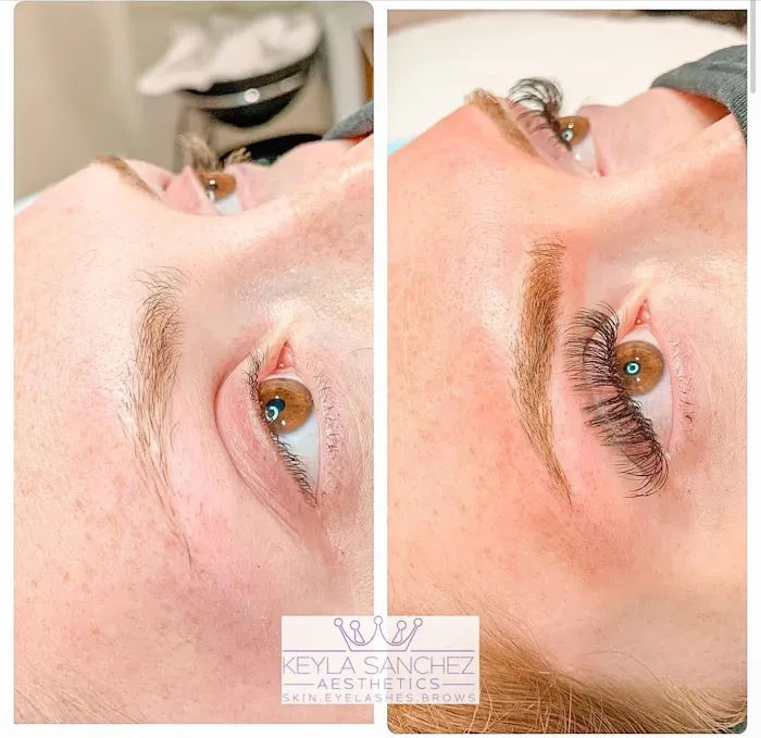 Keyla Sanchez Aesthetics Picture 5