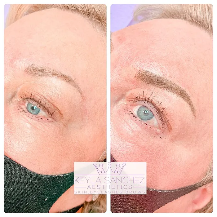 Keyla Sanchez Aesthetics Picture 9