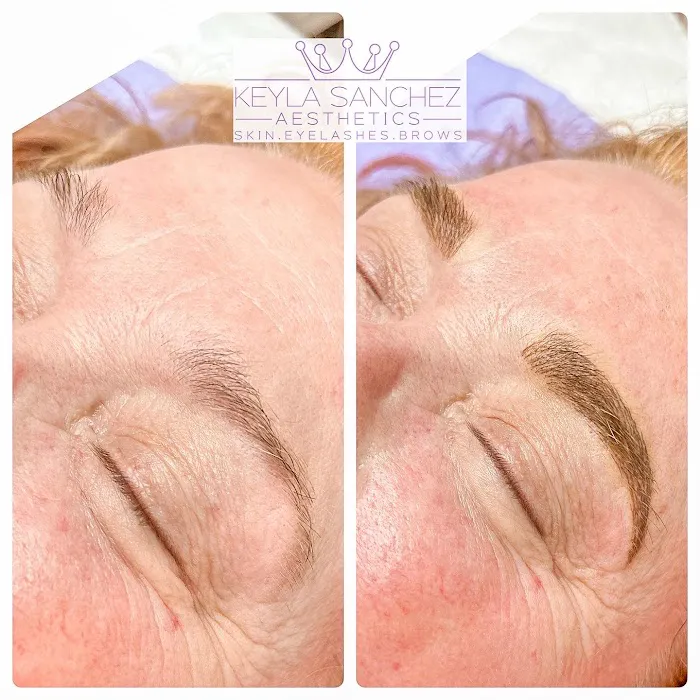 Keyla Sanchez Aesthetics Picture 10