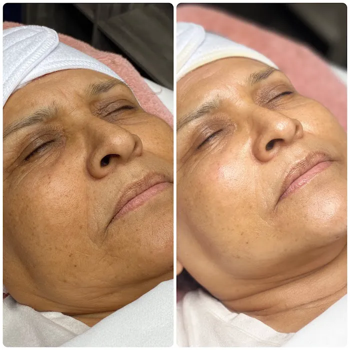 Get Glowin' Aesthetics Picture 3