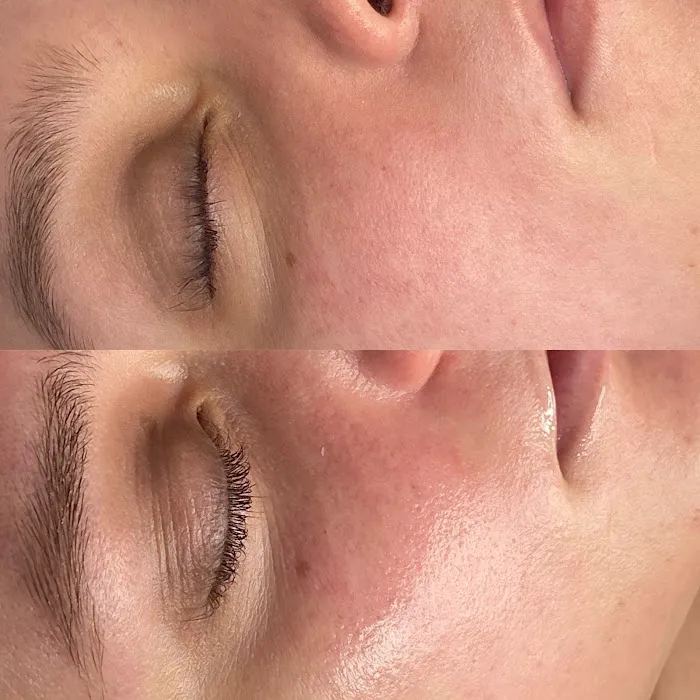 Get Glowin' Aesthetics Picture 1