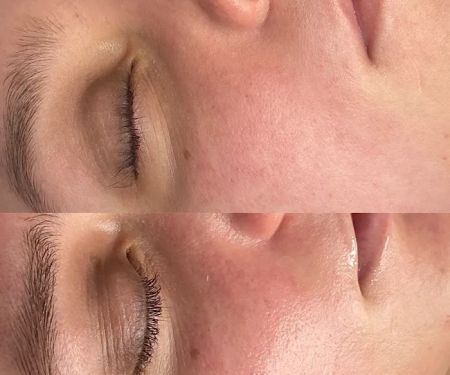 Get Glowin' Aesthetics