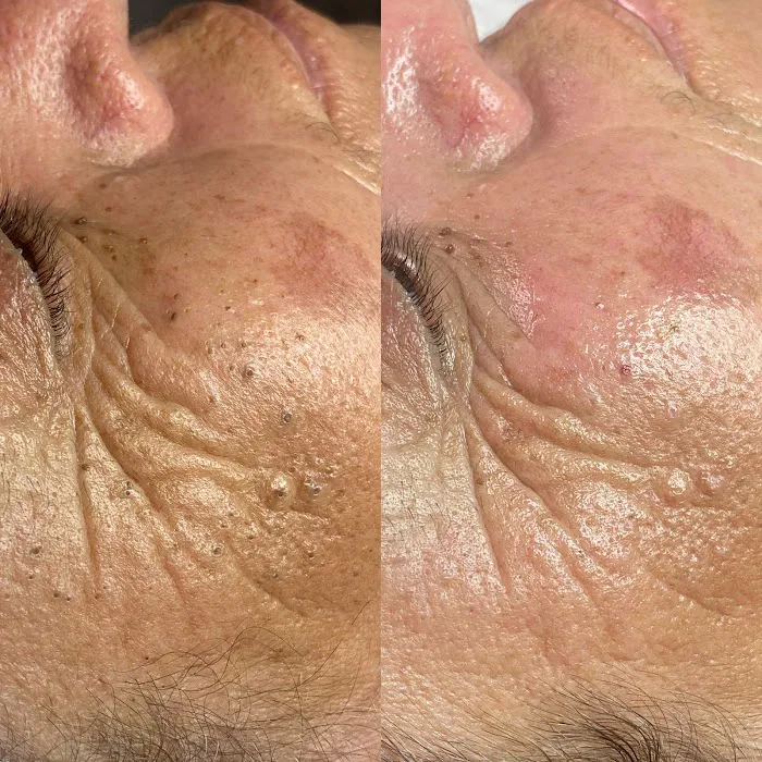 Get Glowin' Aesthetics Picture 4