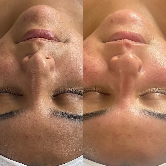 Get Glowin' Aesthetics Picture 7