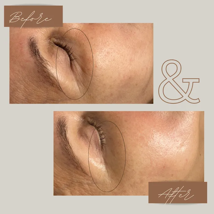 Get Glowin' Aesthetics Picture 6