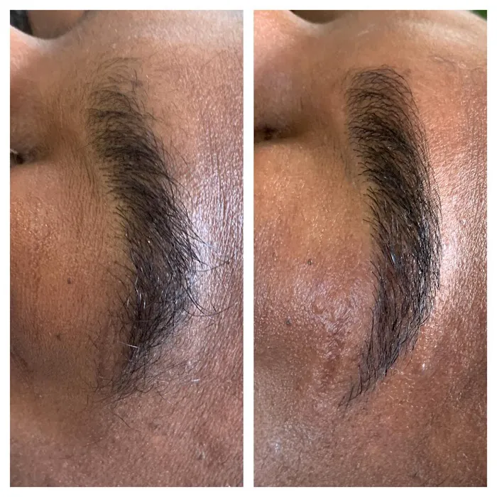 Amla Esthetics Picture 6