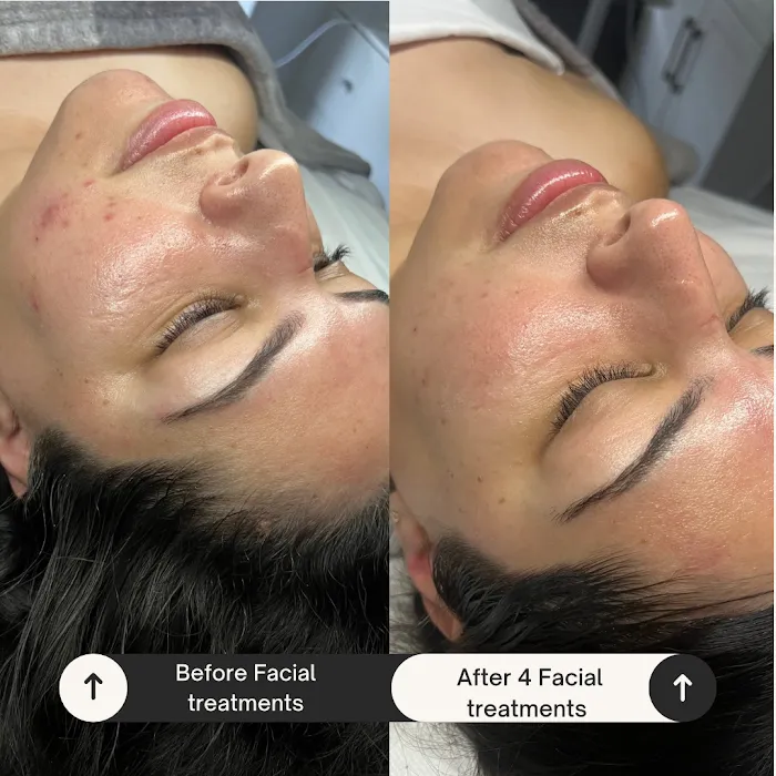 On the Glo beauty suites Picture 6