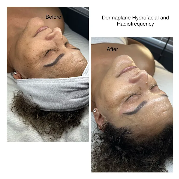 On the Glo beauty suites Picture 5