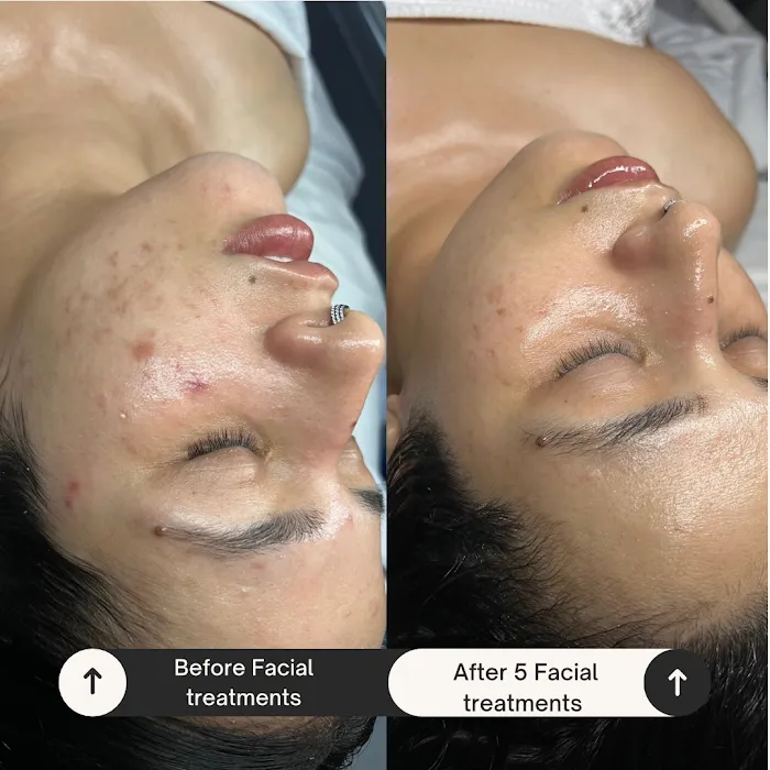 On the Glo beauty suites Picture 10