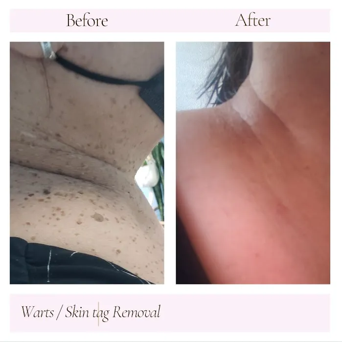 Love your skin, Love yourself Picture 2