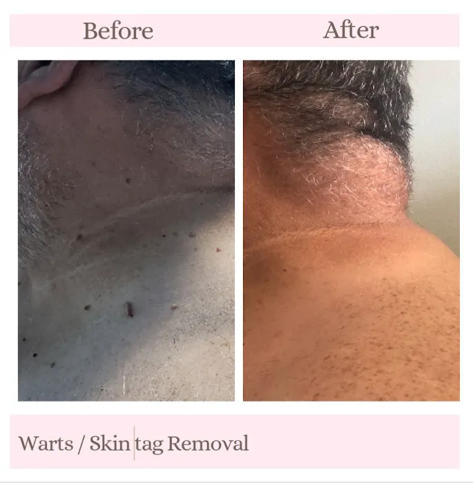 Love your skin, Love yourself Picture 3