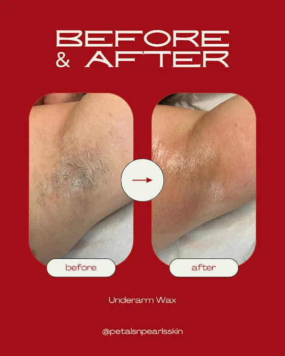 Petals & Pearls Skin Picture 3