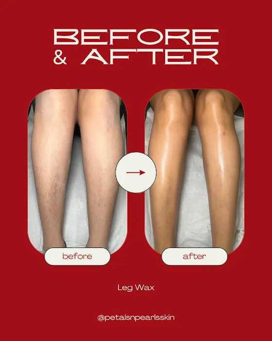 Petals & Pearls Skin Picture 1