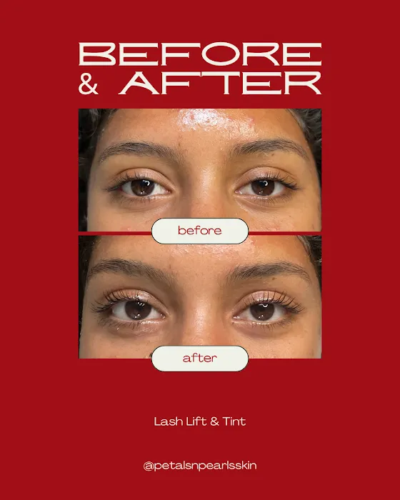 Petals & Pearls Skin Picture 4