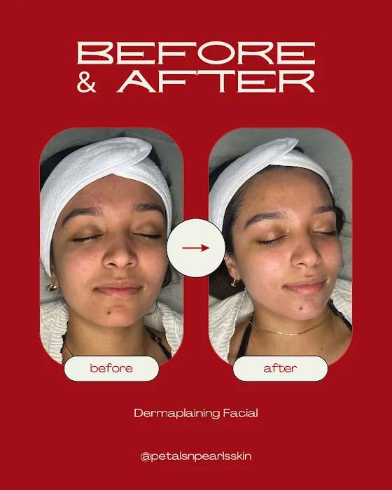 Petals & Pearls Skin Picture 5