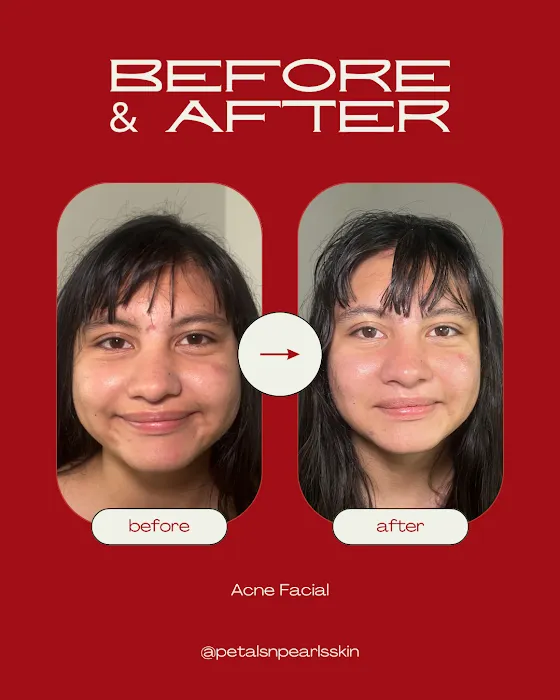 Petals & Pearls Skin Picture 6