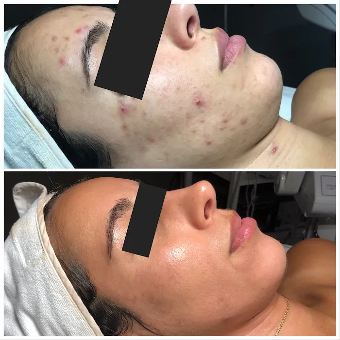 Healthy Beautiful Skin and Tan Picture 2