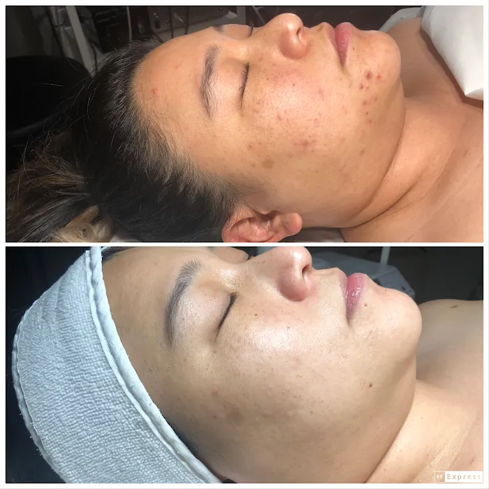 Healthy Beautiful Skin and Tan Picture 3