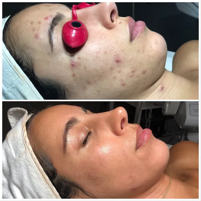 Healthy Beautiful Skin and Tan Picture 5