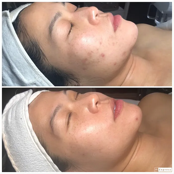 Healthy Beautiful Skin and Tan Picture 6