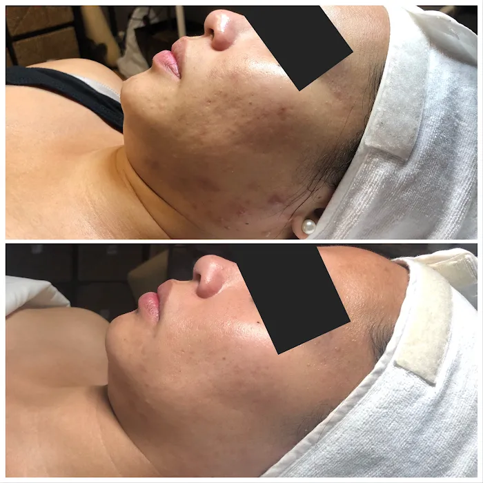 Healthy Beautiful Skin and Tan Picture 9