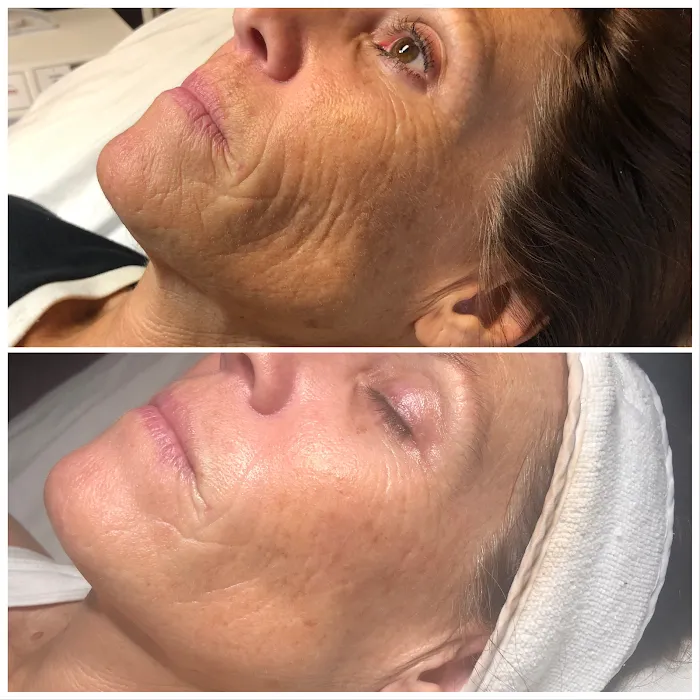 Healthy Beautiful Skin and Tan Picture 10