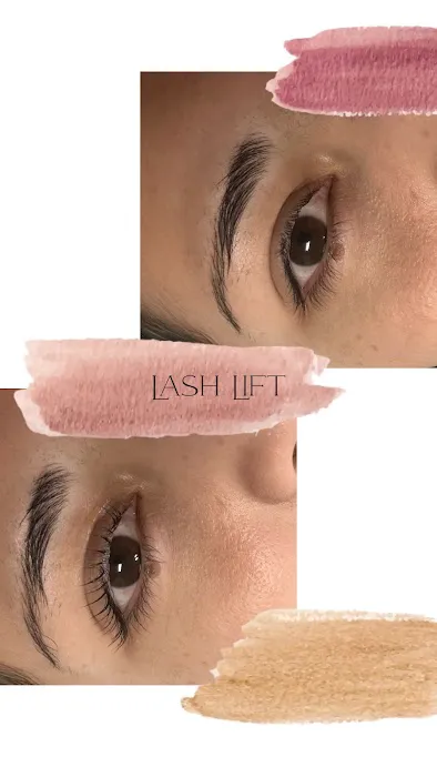 Classic Complexion Picture 7